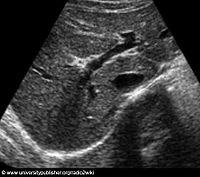 Ultraschall der Bauchorgane